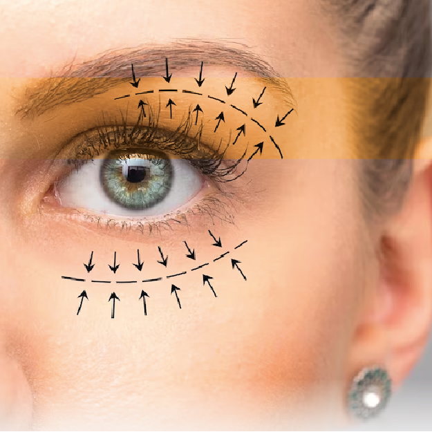 cirugias-faciales-02