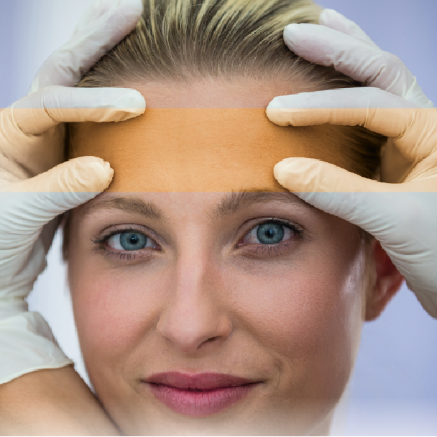 cirugias-faciales-03