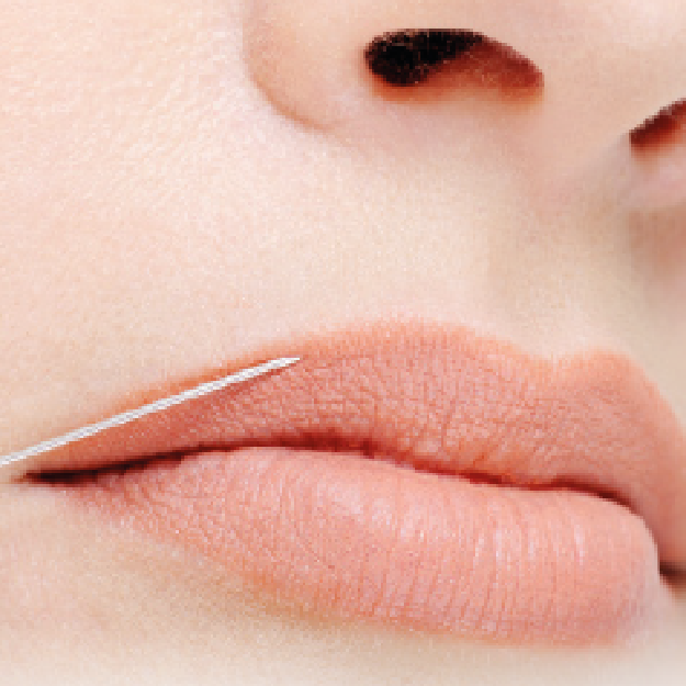 cirugias-faciales-05