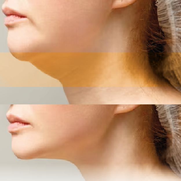 cirugias-faciales-07