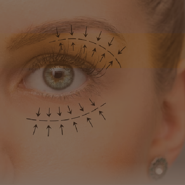 cirugias-faciales-brown-02